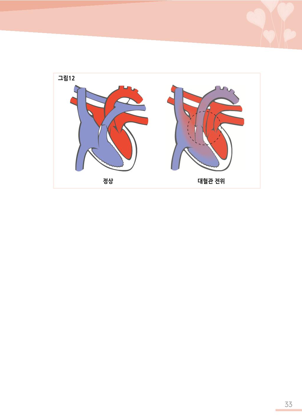 한국심장재단 심장수첩 34페이지