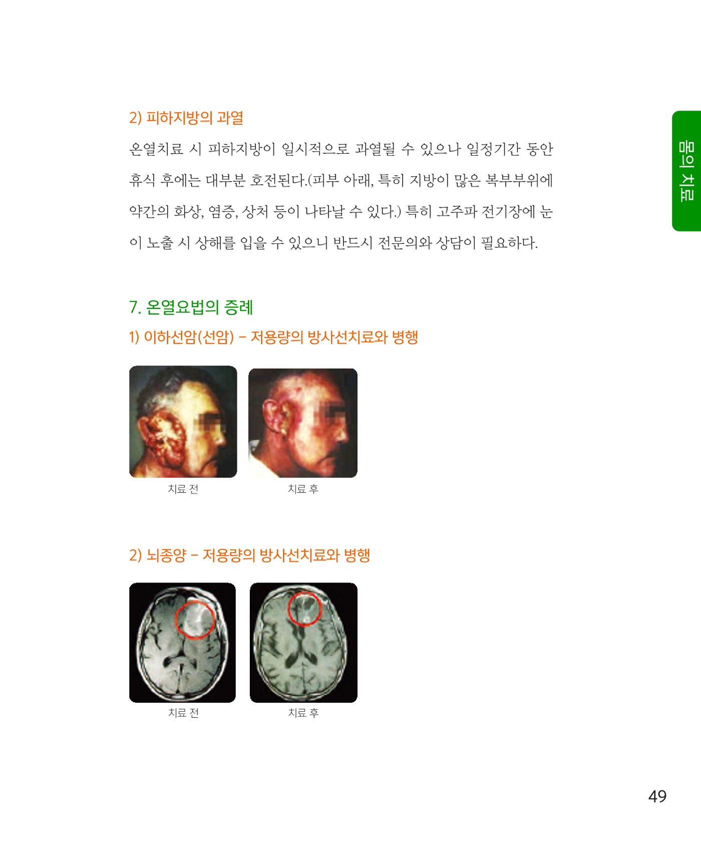 암을 넘어 살림으로 48페이지
