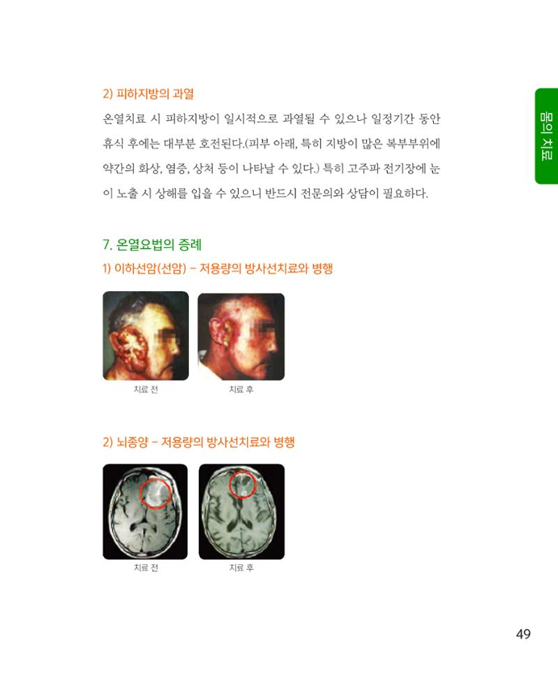 암을 넘어 살림으로 48페이지