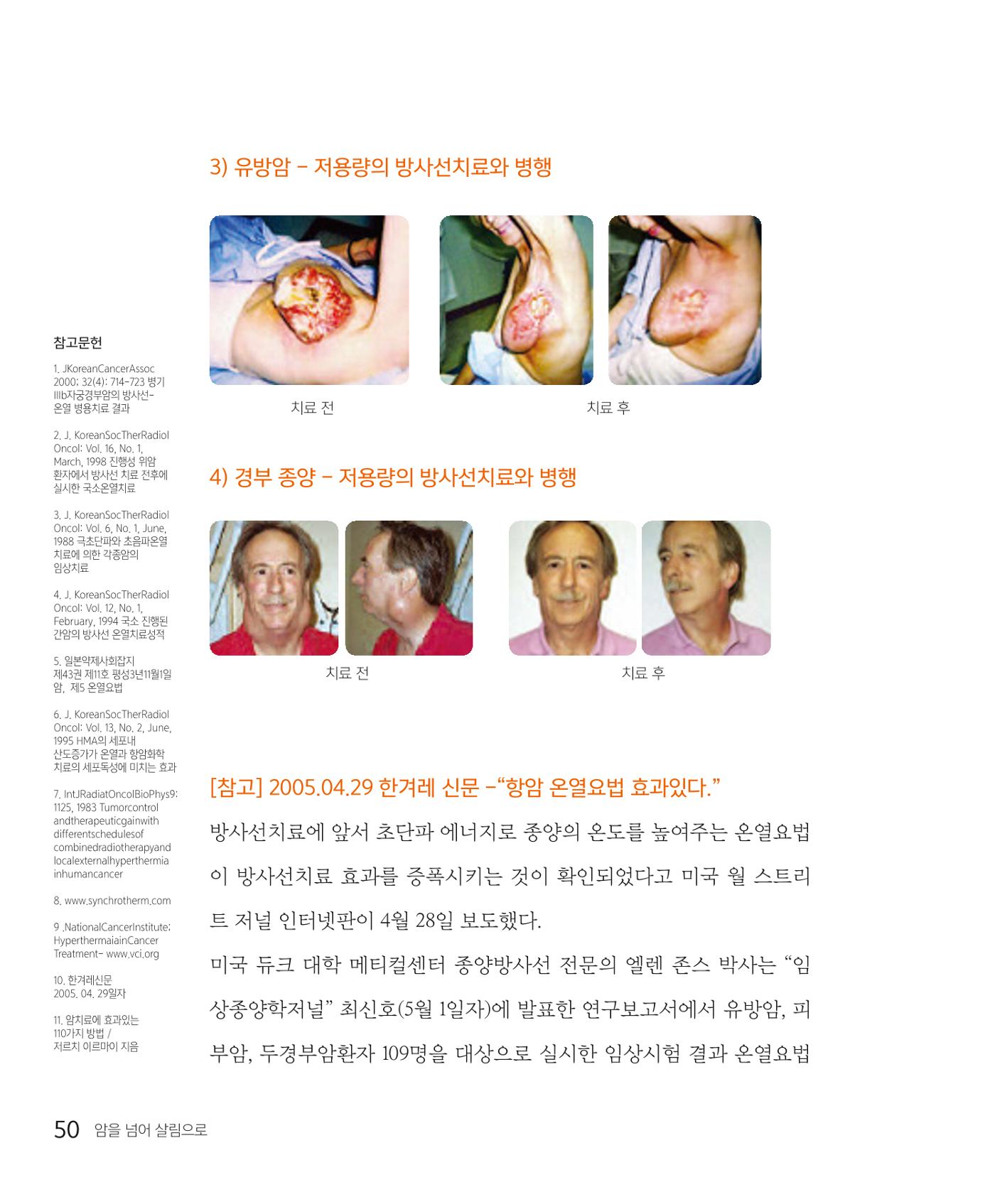 암을 넘어 살림으로 49페이지