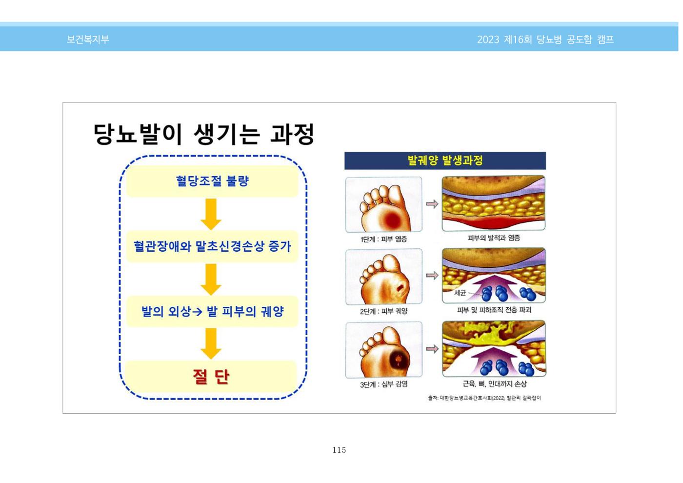 한국소아당뇨인협회 16회 공도함 캠프 E북 자료집 115페이지