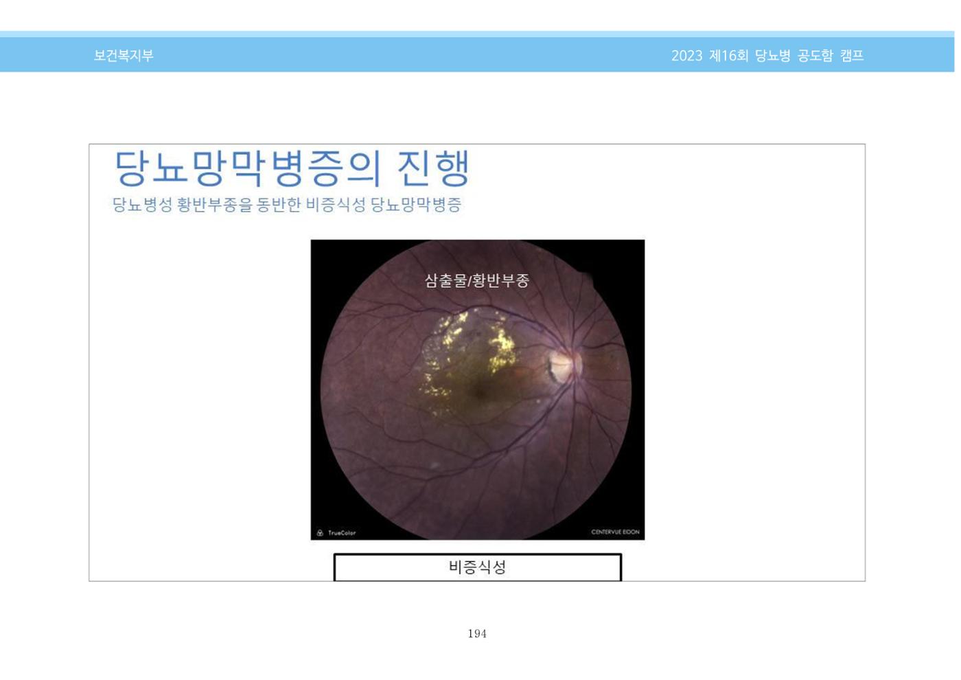 한국소아당뇨인협회 16회 공도함 캠프 E북 자료집 194페이지