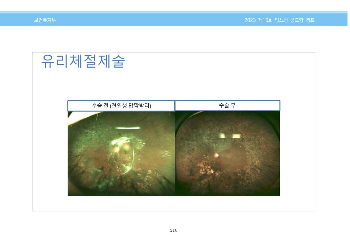 한국소아당뇨인협회 16회 공도함 캠프 E북 자료집 216페이지