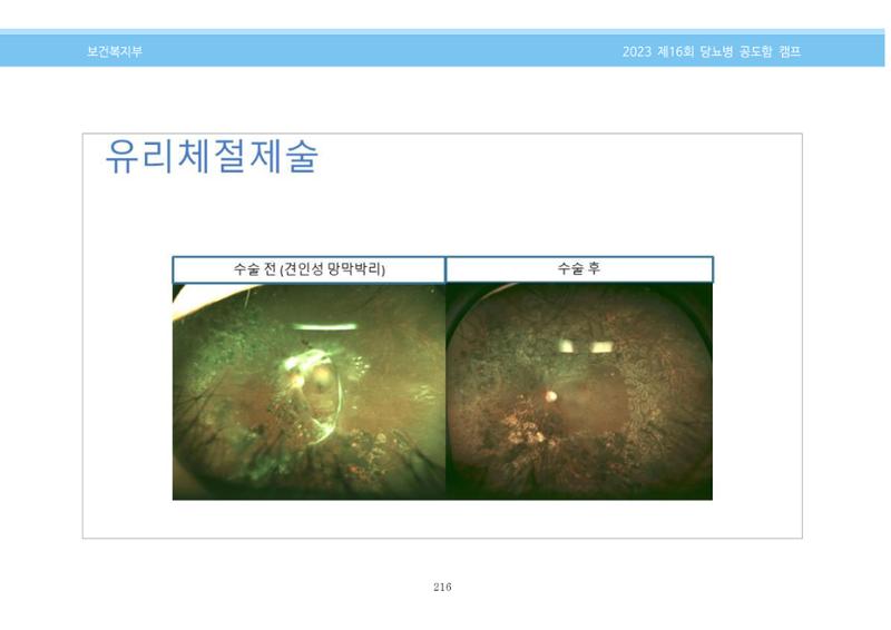 한국소아당뇨인협회 16회 공도함 캠프 E북 자료집 216페이지