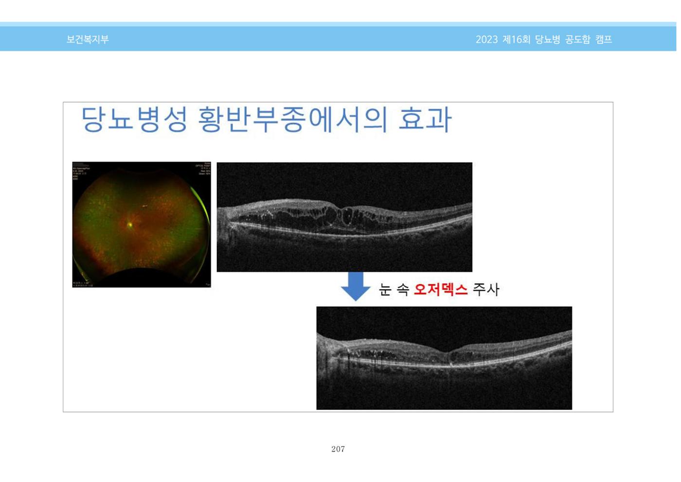 한국소아당뇨인협회 16회 공도함 캠프 E북 자료집 207페이지