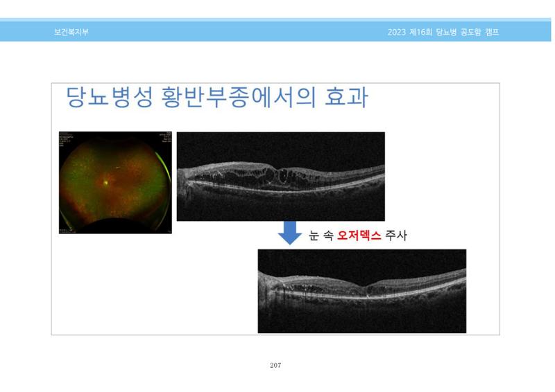 한국소아당뇨인협회 16회 공도함 캠프 E북 자료집 207페이지