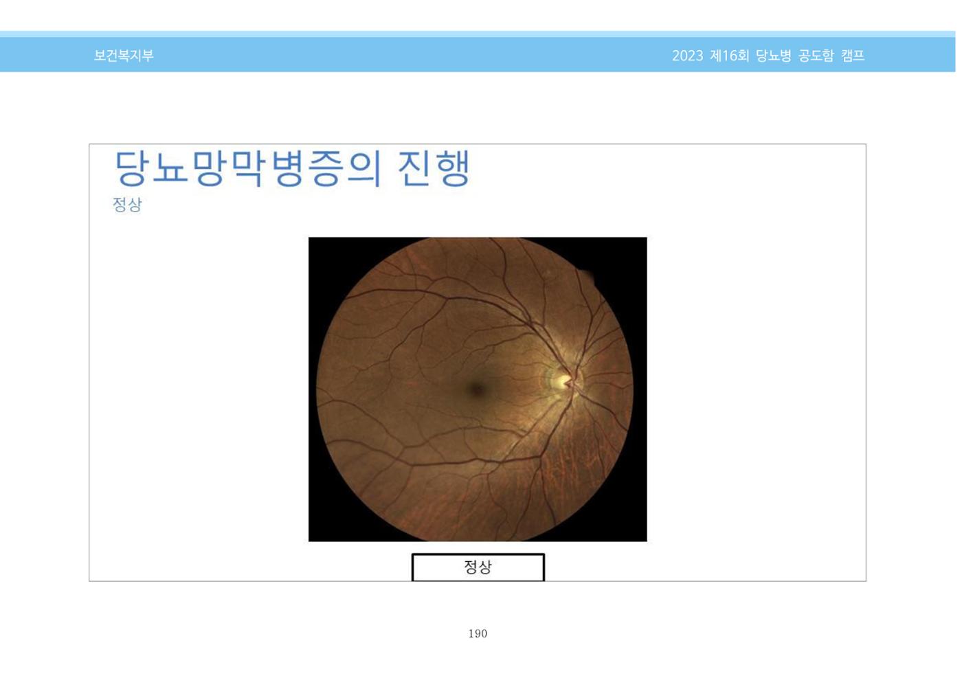 한국소아당뇨인협회 16회 공도함 캠프 E북 자료집 190페이지