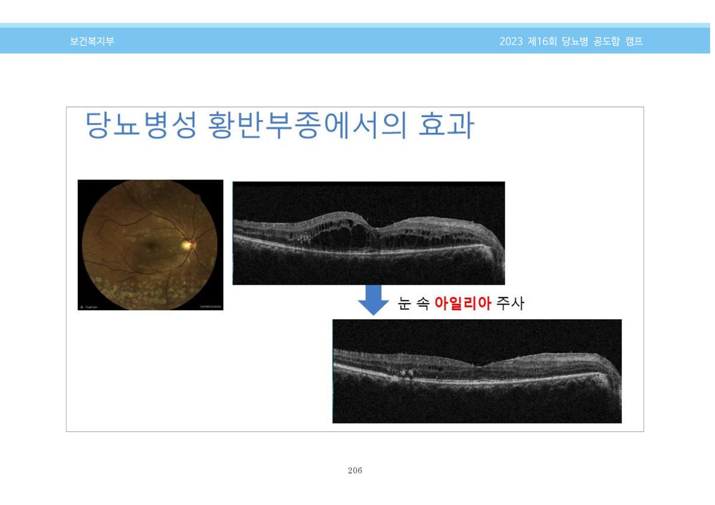 한국소아당뇨인협회 16회 공도함 캠프 E북 자료집 206페이지