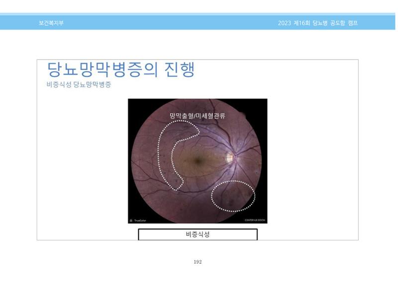 한국소아당뇨인협회 16회 공도함 캠프 E북 자료집 192페이지