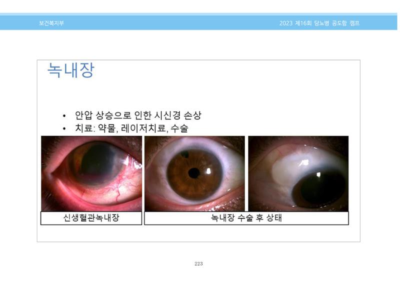 한국소아당뇨인협회 16회 공도함 캠프 E북 자료집 223페이지