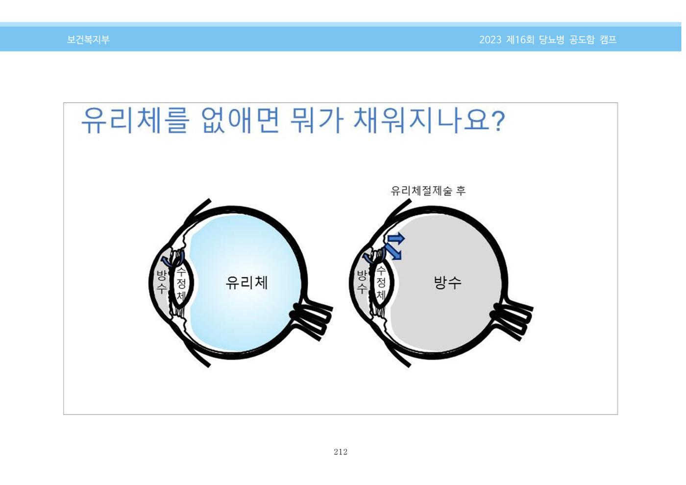 한국소아당뇨인협회 16회 공도함 캠프 E북 자료집 212페이지