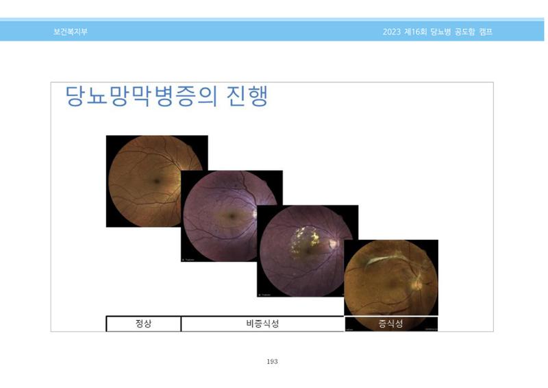 한국소아당뇨인협회 16회 공도함 캠프 E북 자료집 193페이지