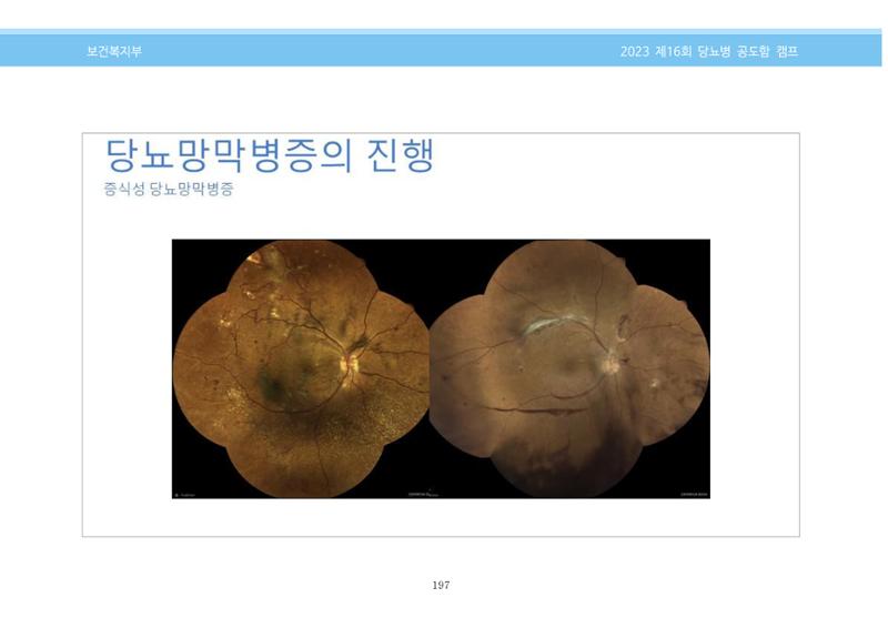 한국소아당뇨인협회 16회 공도함 캠프 E북 자료집 197페이지