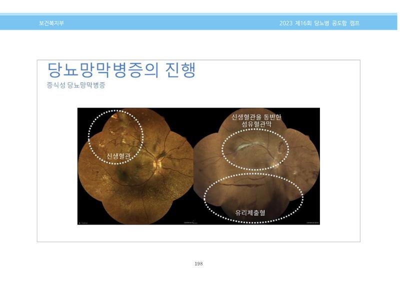 한국소아당뇨인협회 16회 공도함 캠프 E북 자료집 198페이지