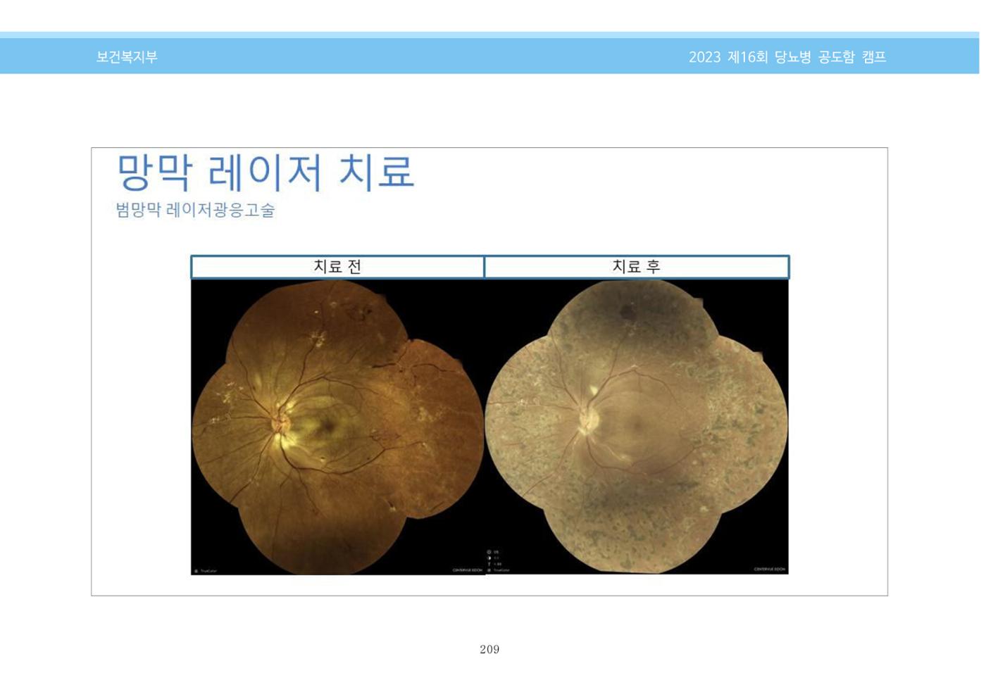 한국소아당뇨인협회 16회 공도함 캠프 E북 자료집 209페이지