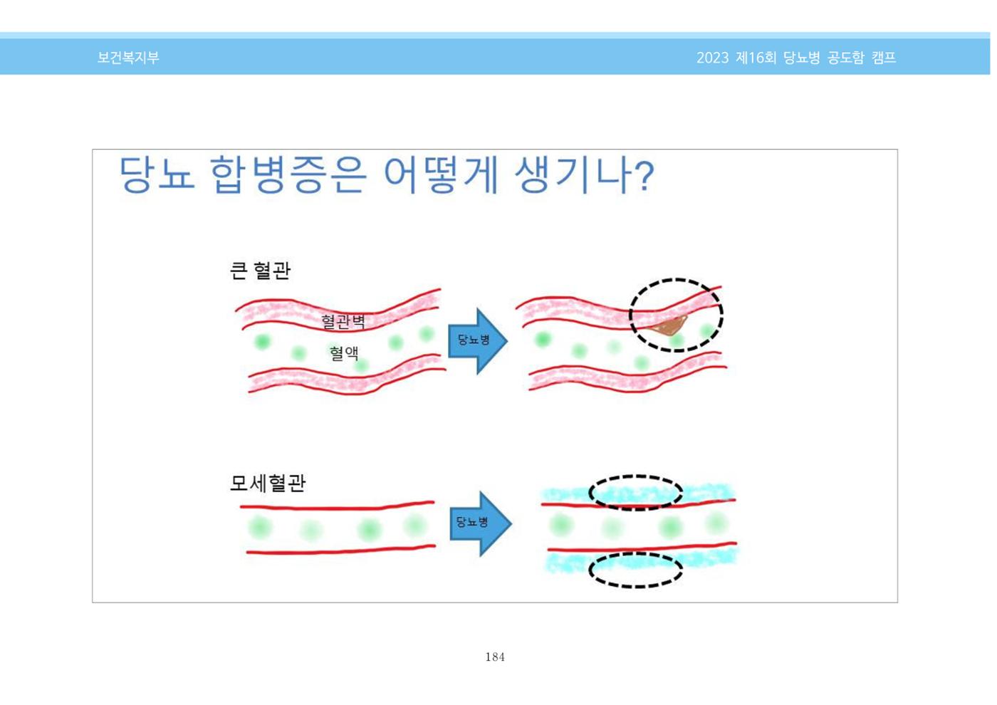 한국소아당뇨인협회 16회 공도함 캠프 E북 자료집 184페이지