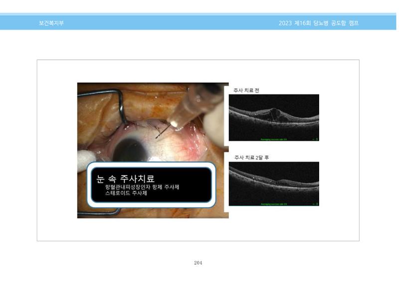 한국소아당뇨인협회 16회 공도함 캠프 E북 자료집 204페이지
