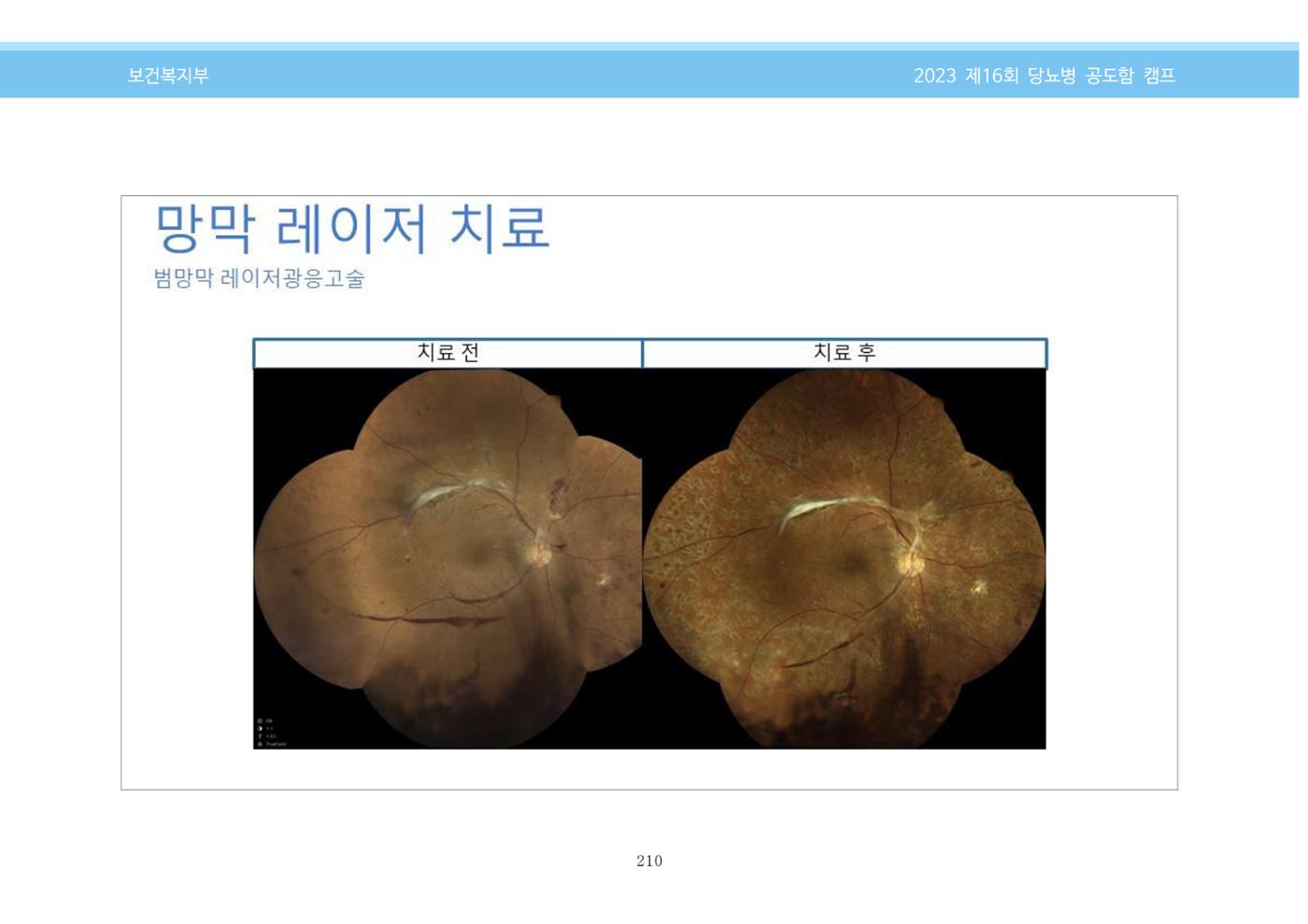 한국소아당뇨인협회 16회 공도함 캠프 E북 자료집 210페이지
