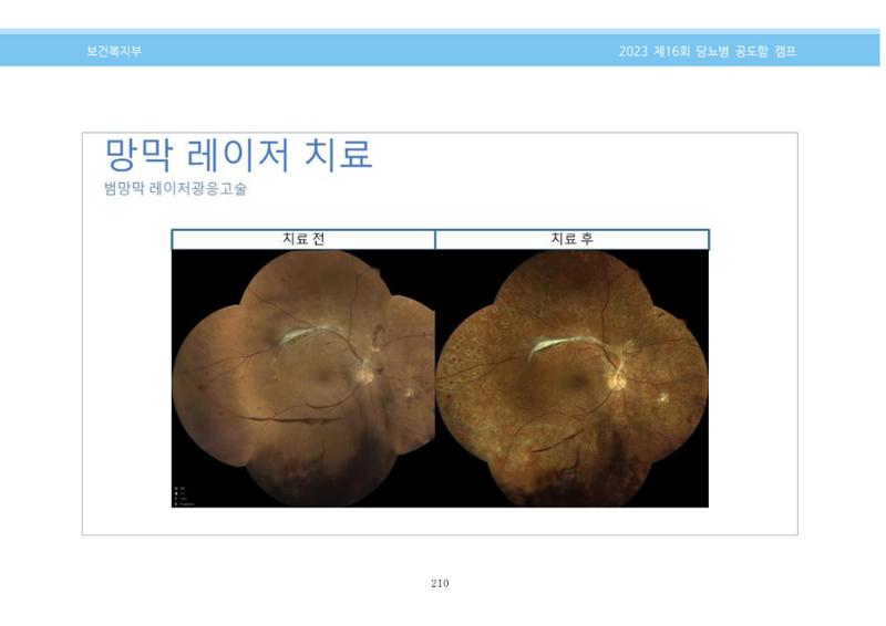 한국소아당뇨인협회 16회 공도함 캠프 E북 자료집 210페이지