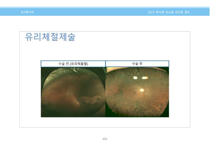 한국소아당뇨인협회 16회 공도함 캠프 E북 자료집 215페이지