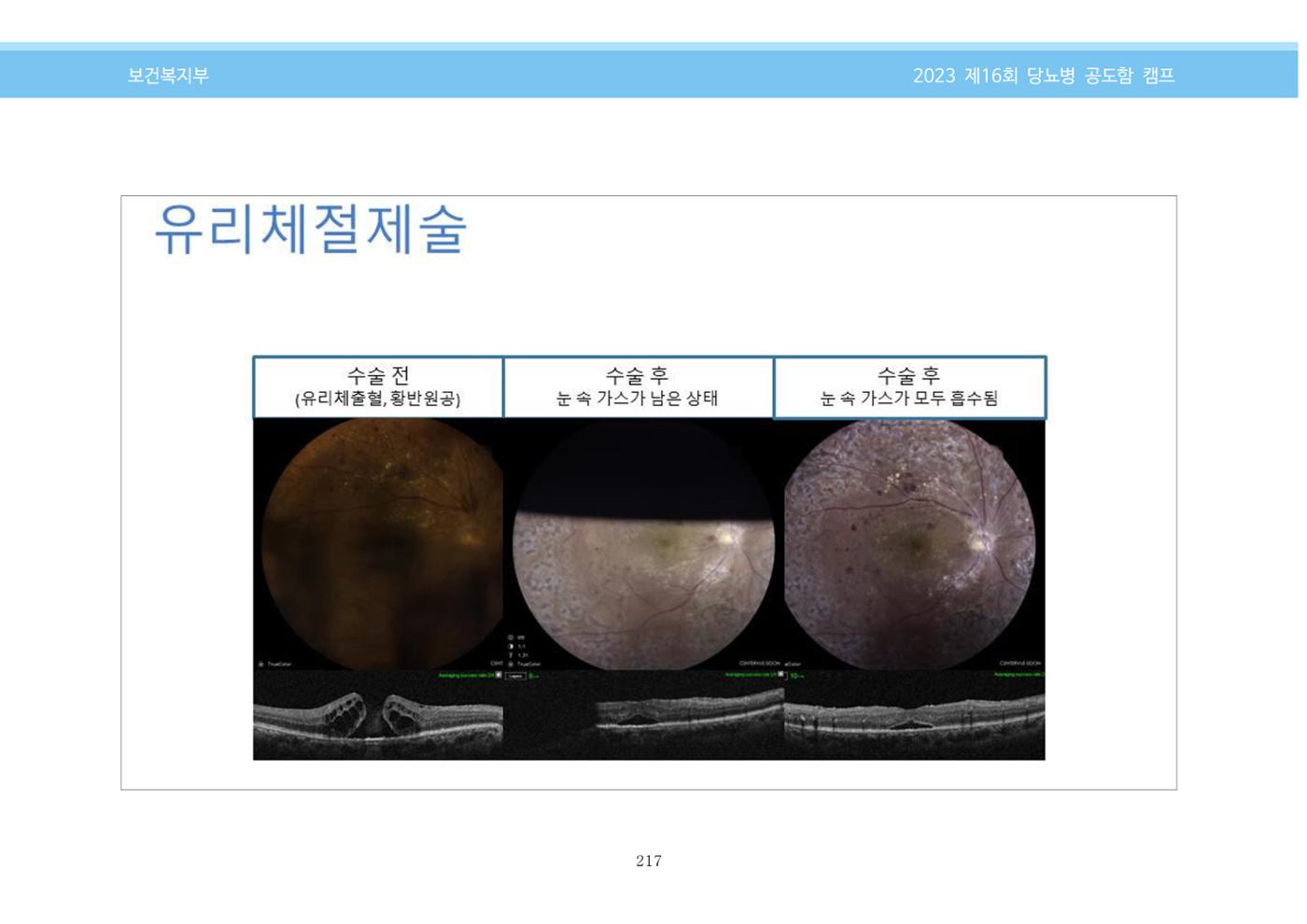 한국소아당뇨인협회 16회 공도함 캠프 E북 자료집 217페이지
