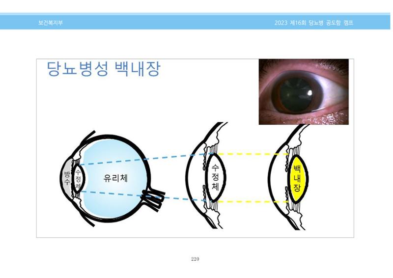 한국소아당뇨인협회 16회 공도함 캠프 E북 자료집 220페이지