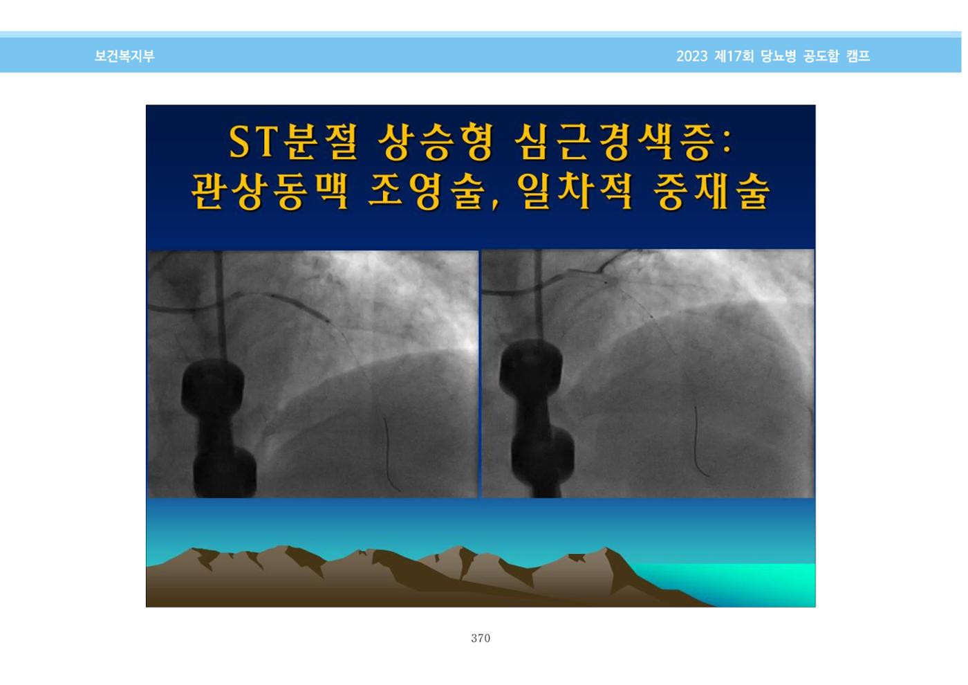 한국소아당뇨인협회 17회 공도함 캠프 E북 자료집 370페이지