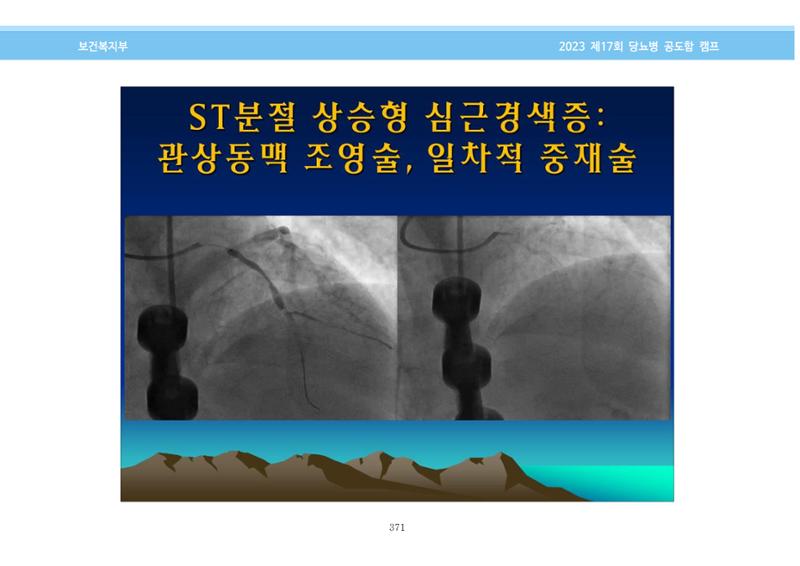 한국소아당뇨인협회 17회 공도함 캠프 E북 자료집 371페이지