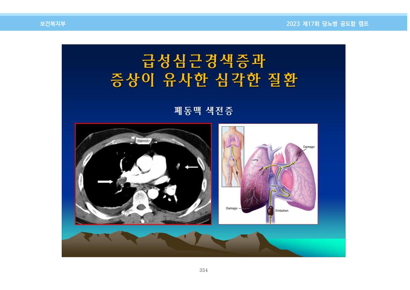 한국소아당뇨인협회 17회 공도함 캠프 E북 자료집 354페이지