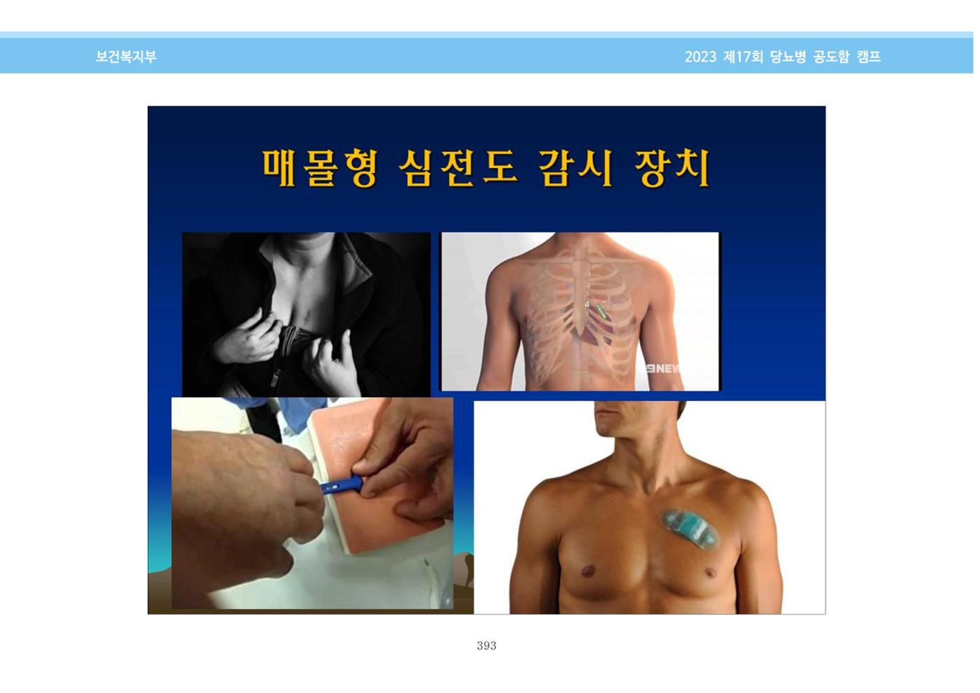 한국소아당뇨인협회 17회 공도함 캠프 E북 자료집 393페이지