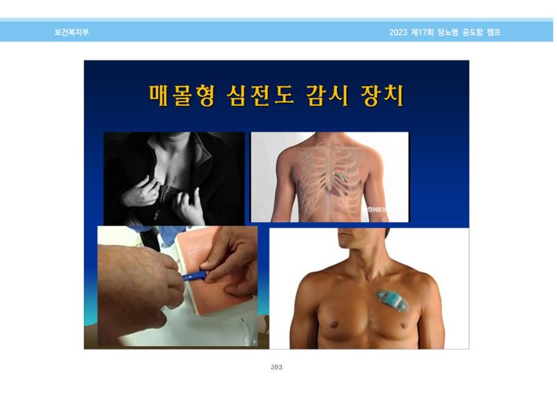한국소아당뇨인협회 17회 공도함 캠프 E북 자료집 393페이지