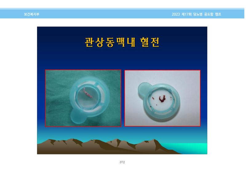 한국소아당뇨인협회 17회 공도함 캠프 E북 자료집 372페이지