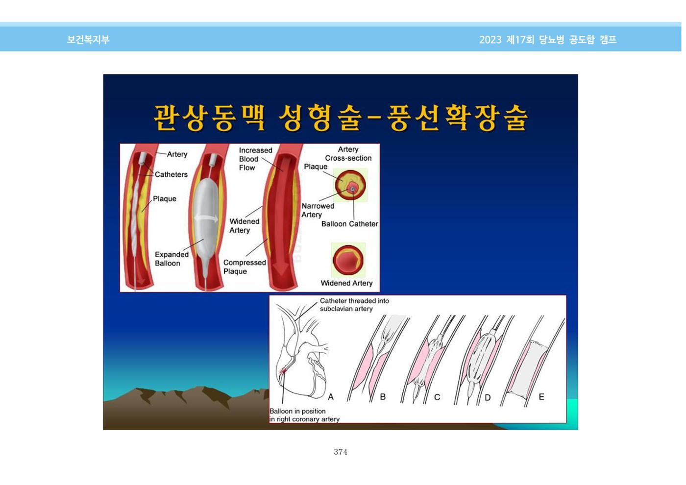한국소아당뇨인협회 17회 공도함 캠프 E북 자료집 374페이지