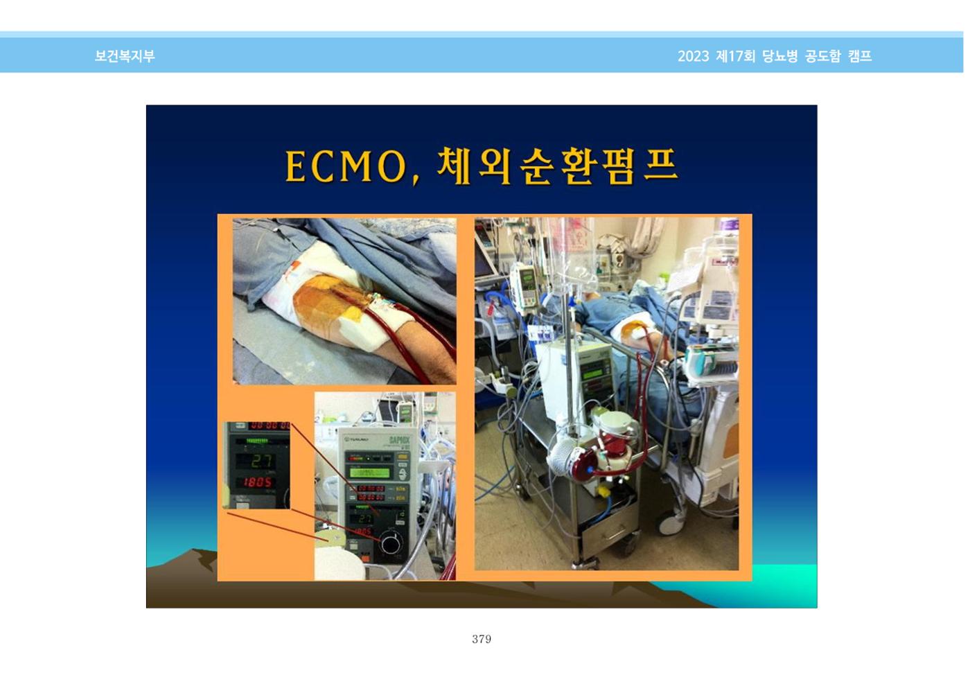 한국소아당뇨인협회 17회 공도함 캠프 E북 자료집 379페이지