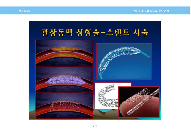 한국소아당뇨인협회 17회 공도함 캠프 E북 자료집 376페이지