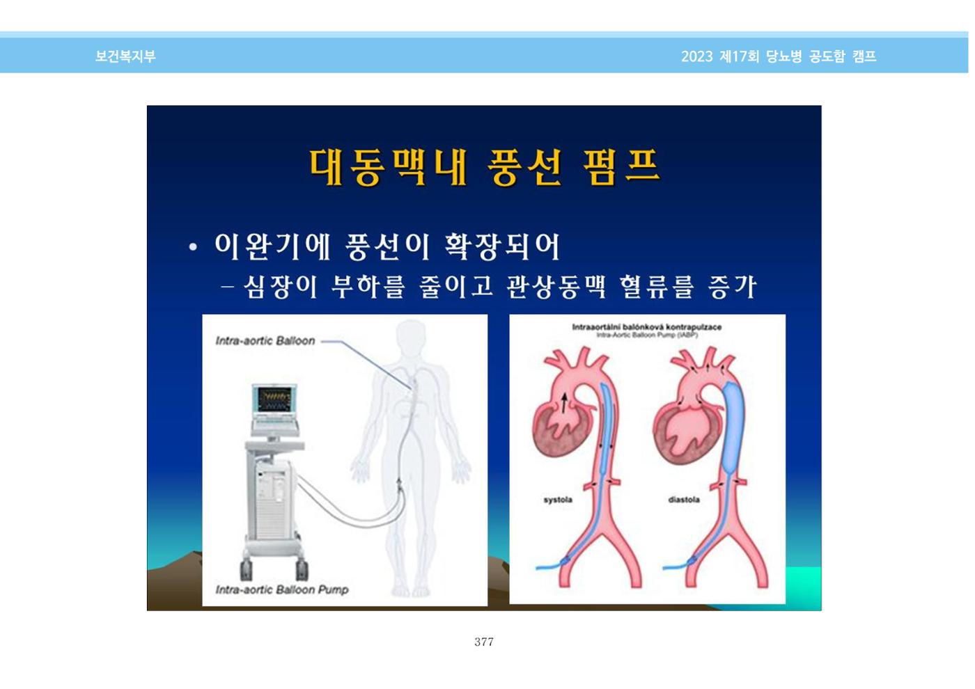 한국소아당뇨인협회 17회 공도함 캠프 E북 자료집 377페이지