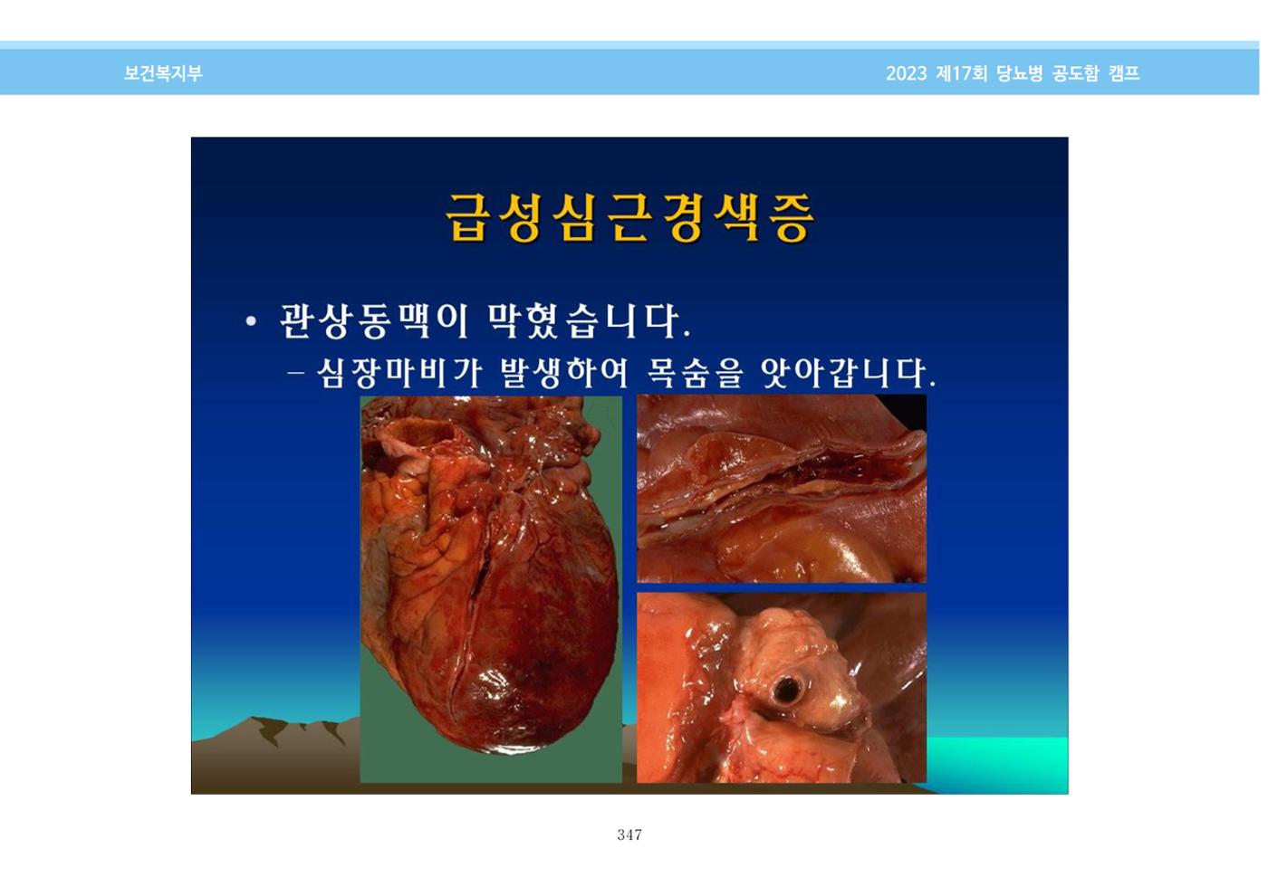 한국소아당뇨인협회 17회 공도함 캠프 E북 자료집 347페이지
