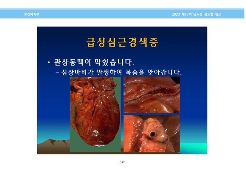 한국소아당뇨인협회 17회 공도함 캠프 E북 자료집 347페이지