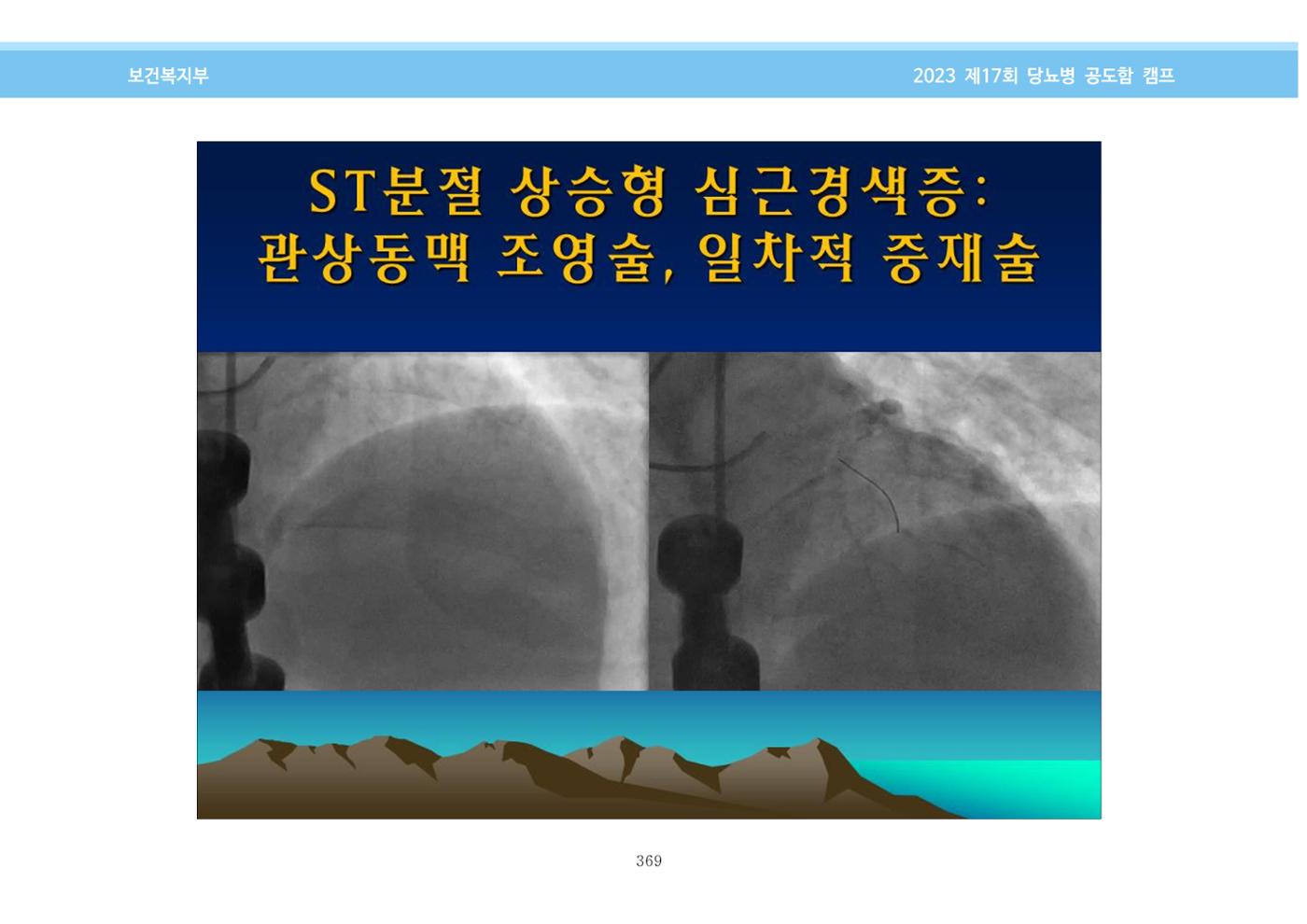 한국소아당뇨인협회 17회 공도함 캠프 E북 자료집 369페이지