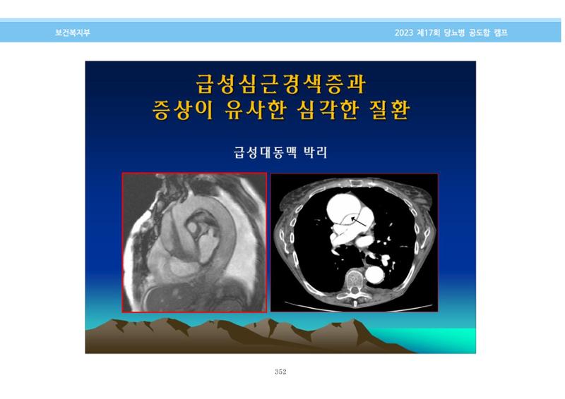 한국소아당뇨인협회 17회 공도함 캠프 E북 자료집 352페이지