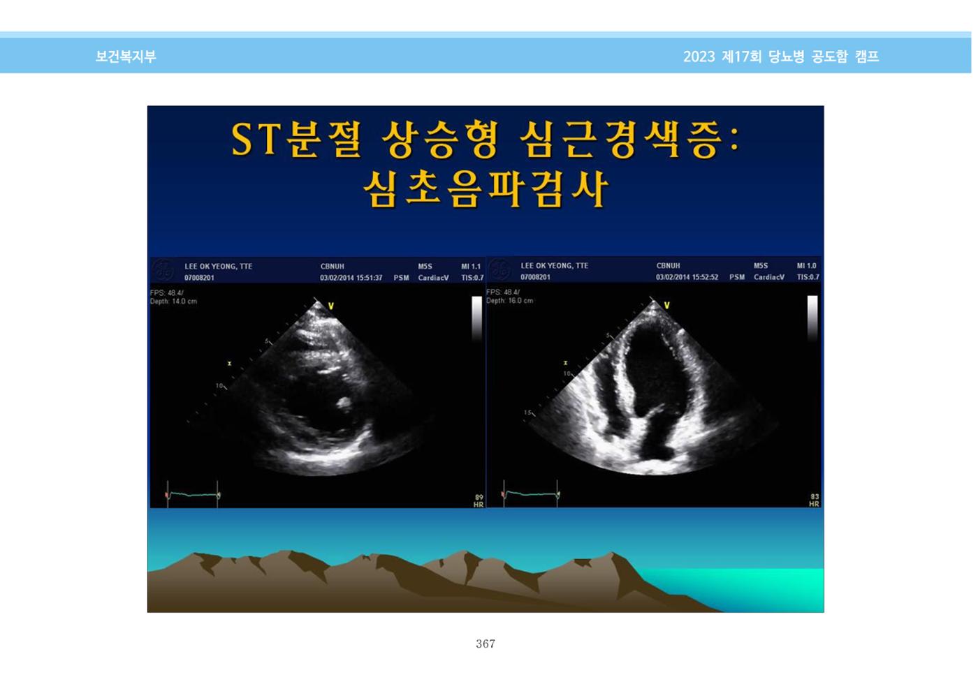 한국소아당뇨인협회 17회 공도함 캠프 E북 자료집 367페이지