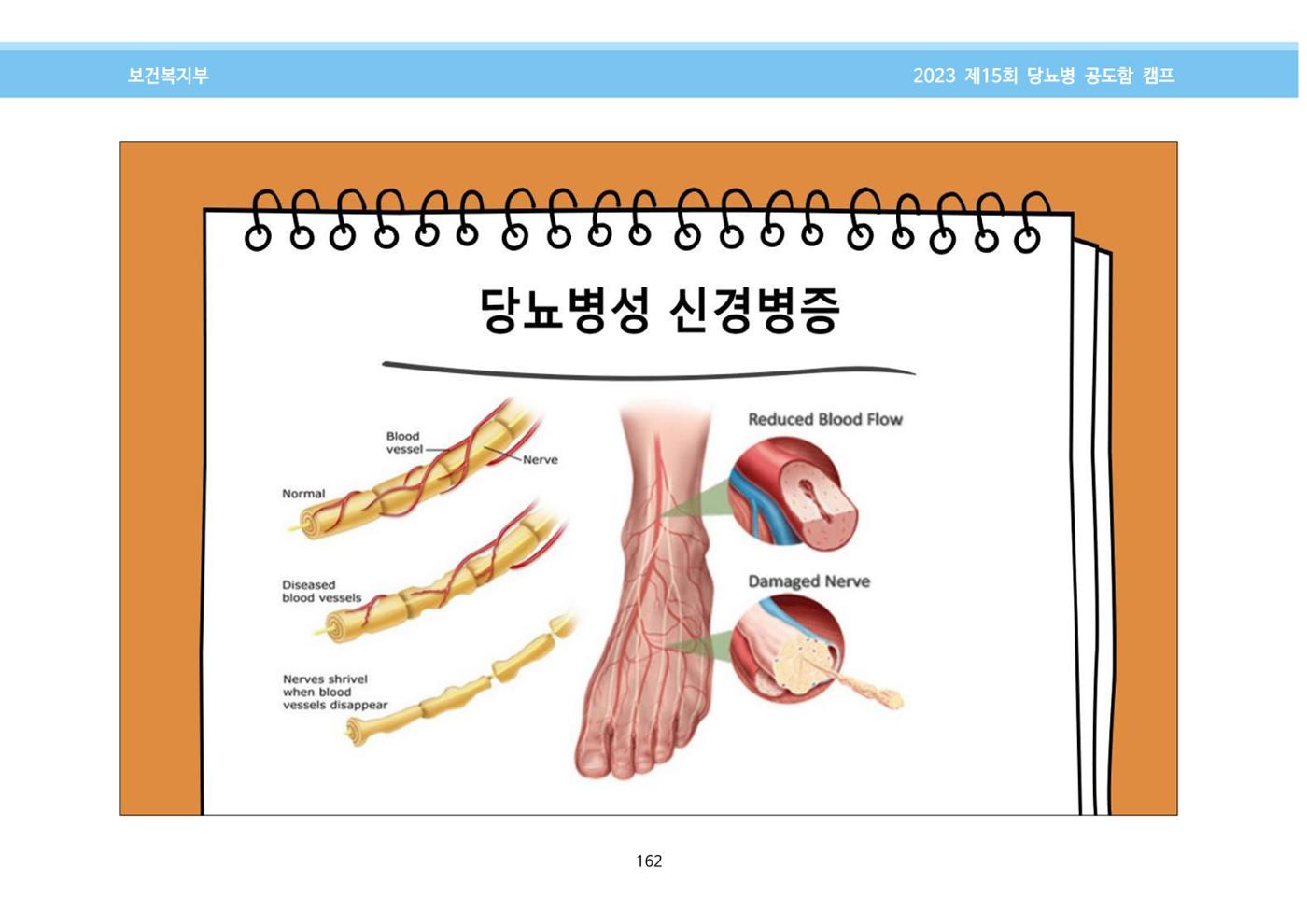 한국소아당뇨인협회 15회 공도함 캠프 E북 자료집 162페이지
