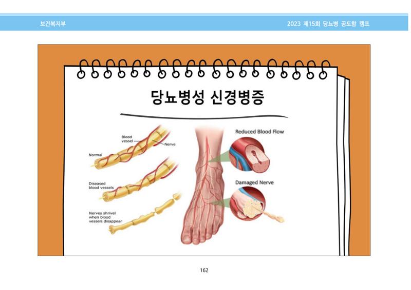 한국소아당뇨인협회 15회 공도함 캠프 E북 자료집 162페이지