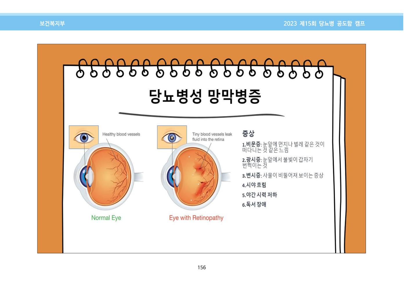 한국소아당뇨인협회 15회 공도함 캠프 E북 자료집 156페이지