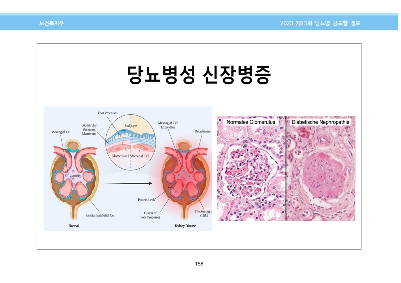 한국소아당뇨인협회 15회 공도함 캠프 E북 자료집 158페이지