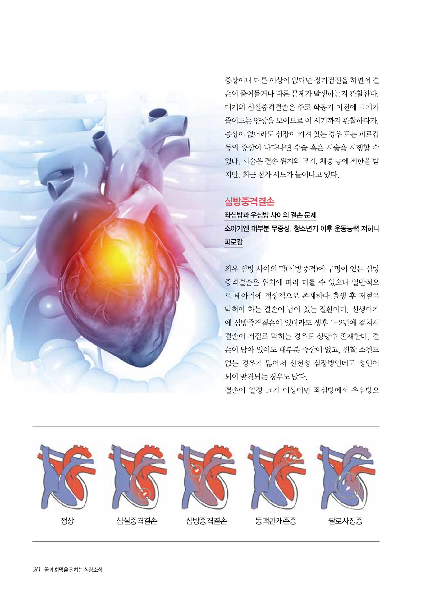 2024 심장소식 봄호 141호 20페이지