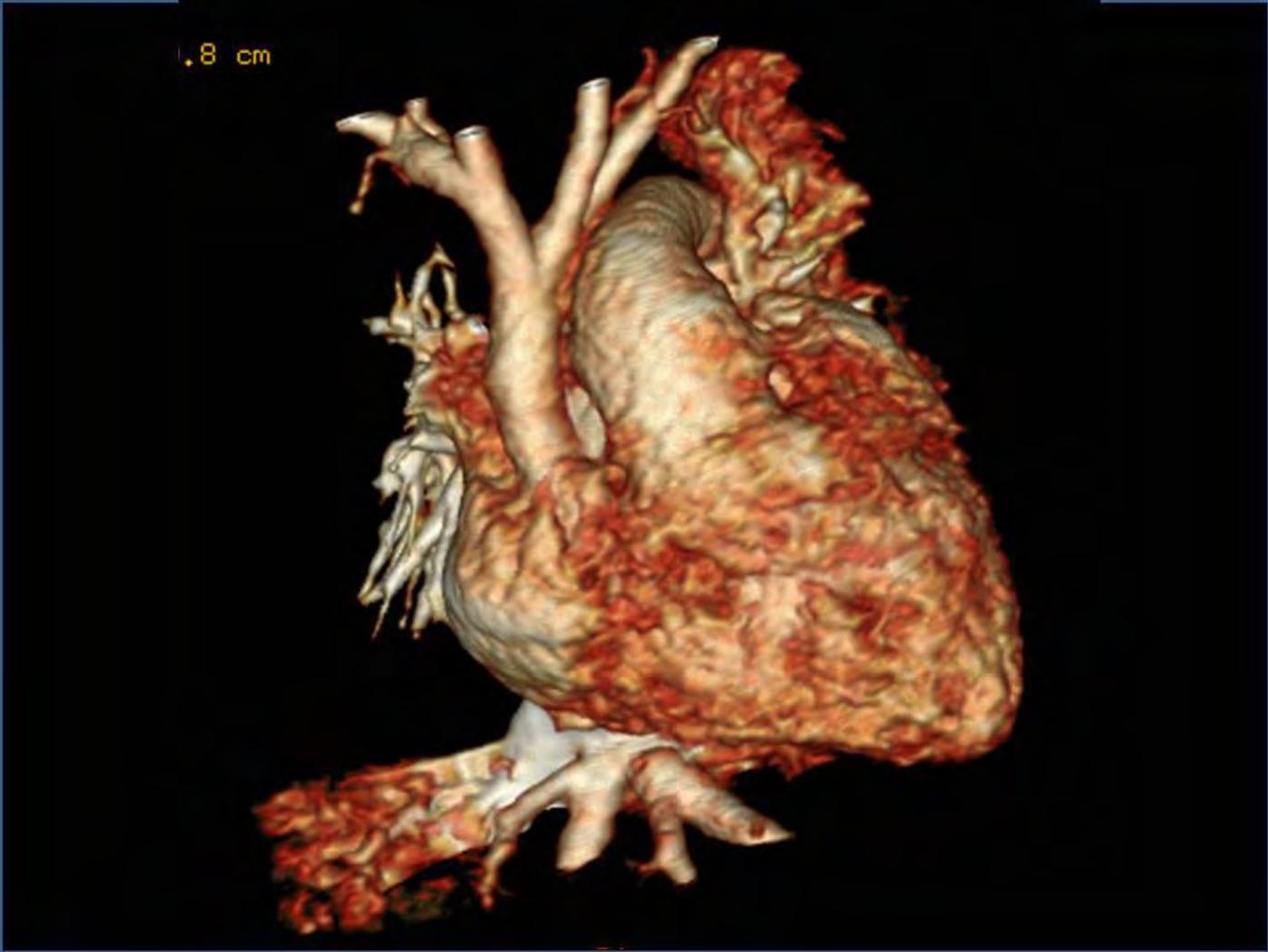 2025 Pediatric Heart Forum Presentation 324페이지