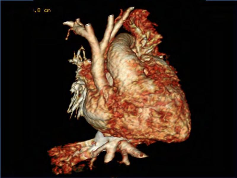 2025 Pediatric Heart Forum Presentation 324페이지