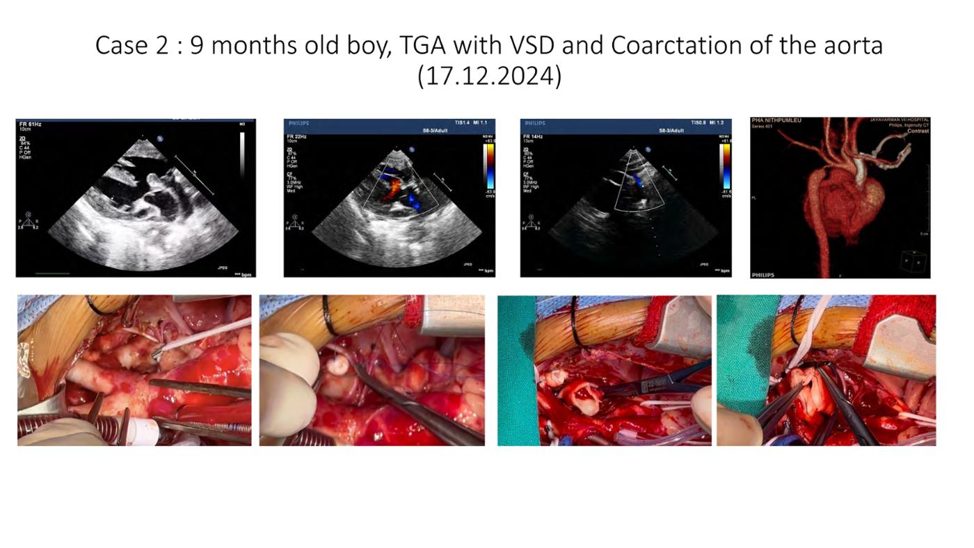 2025 Pediatric Heart Forum Presentation 392페이지