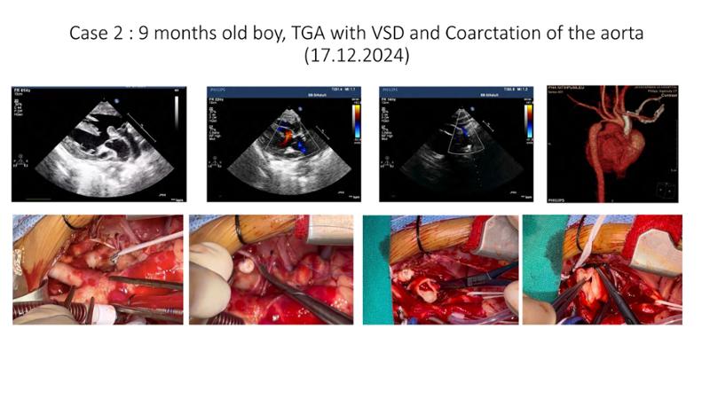 2025 Pediatric Heart Forum Presentation 392페이지
